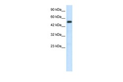 Aviva Systems Biology Corp SMAD6 Antibody - N-terminal region (P100717_P050)