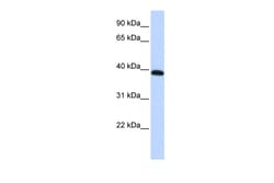 Aviva Systems Biology Corp HOXA10 Antibody - middle region (P100768_P050)