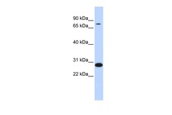 Aviva Systems Biology Corp TCF12 Antibody - middle region (P100772_P050)