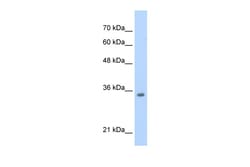 Aviva Systems Biology Corp TCF4 Antibody - N-terminal region (P100776_P050)