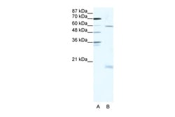 Aviva Systems Biology Corp SOX9 Antibody - N-terminal region (P100797_T100)