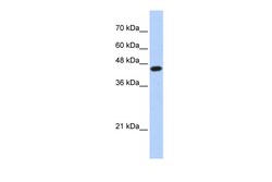 Aviva Systems Biology Corp E2F1 Antibody - N-terminal region (P100821_P050)