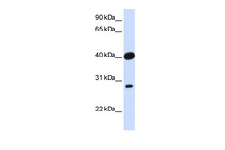 Aviva Systems Biology Corp ELK3 Antibody - middle region (P100856_P050)