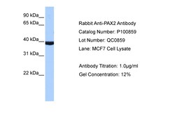 Aviva Systems Biology Corp PAX2 Antibody - middle region (P100859_P050)