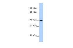 Aviva Systems Biology Corp ZNF187 Antibody - C-terminal region (P100865_T100)