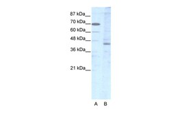 Aviva Systems Biology Corp LHX2 Antibody - middle region (P100884_T100)