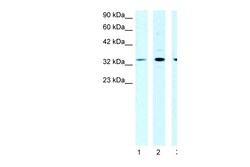Aviva Systems Biology Corp CSDA Antibody - N-terminal region (P100916_T100)
