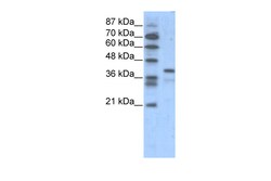 Aviva Systems Biology Corp POU5F1 Antibody - N-terminal region (P100956_T100)