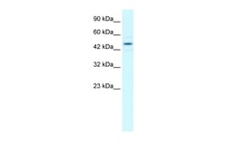 Aviva Systems Biology Corp ELOC Antibody - middle region (P100962_T100)