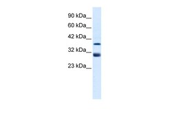 Aviva Systems Biology Corp TAL1 Antibody - middle region (P100970_P050)