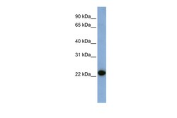 Aviva Systems Biology Corp CAV1 Antibody - N-terminal region (P100998_P050)