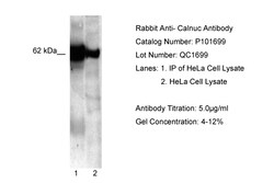 Aviva Systems Biology Corp NUCB1 Antibody - C-terminal region (P101699_T100)