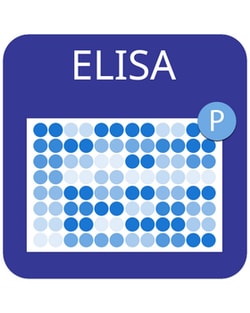 Raybiotech Inc Human Phospho-ATM (S1981) and Total ATM ELISA Kit, 2-Pack,