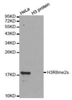 Epigentek Inc Histone H3R8 Dimethyl Symmetric (H3R8me2s) Polyclonal Antibody