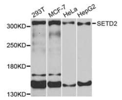 Epigentek Inc SETD2 Polyclonal Antibody (100 ul), Quantity: Each of 1