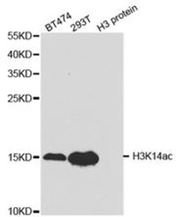 Epigentek Inc Histone H3K14ac (Acetyl H3K14) Polyclonal Antibody (25 ul),