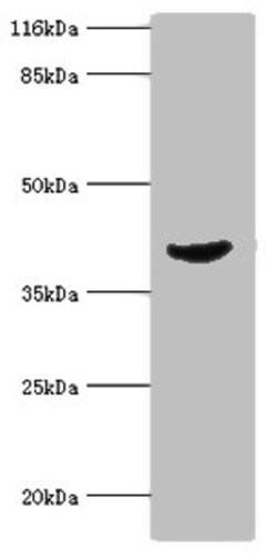Epigentek Inc ADA Polyclonal Antibody (100 ul), Quantity: Each of 1