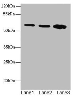 Epigentek Inc SPTLC2 Polyclonal Antibody (100 ul), Quantity: Each of 1