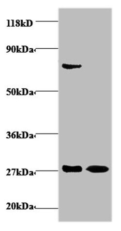 Epigentek Inc IFNG Polyclonal Antibody (100 ul), Quantity: Each of 1
