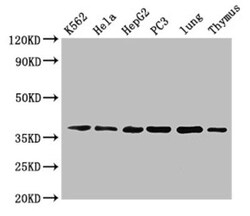 Epigentek Inc Anxa1 Polyclonal Antibody, Biotin Conjulated (50 ul), Quantity: