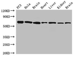 Epigentek Inc GPI Polyclonal Antibody (100 ul), Quantity: Each of 1