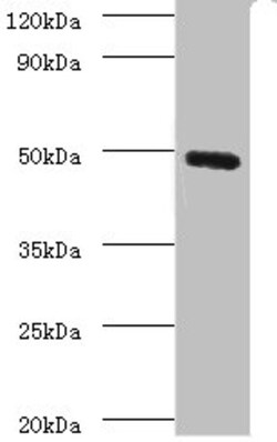 Epigentek Inc CLEC18A Polyclonal Antibody (100 ul), Quantity: Each of 1