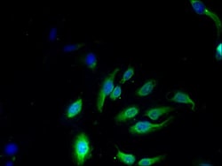 Epigentek Inc NKG7 Polyclonal Antibody (100 ul), Quantity: Each of 1
