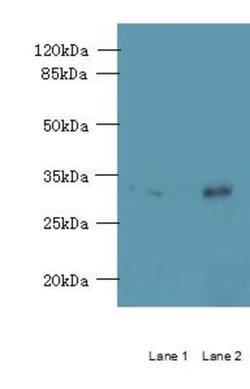 Epigentek Inc RTP4 Polyclonal Antibody (100 ul), Quantity: Each of 1
