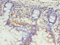 Epigentek Inc SETX Polyclonal Antibody (100 ul), Quantity: Each of 1