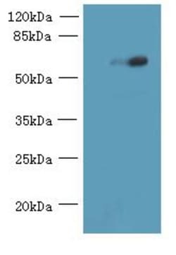 Epigentek Inc USP30 Polyclonal Antibody (100 ul), Quantity: Each of 1