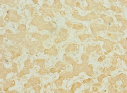 Epigentek Inc TEKT3 Polyclonal Antibody (50 ul), Quantity: Each of 1