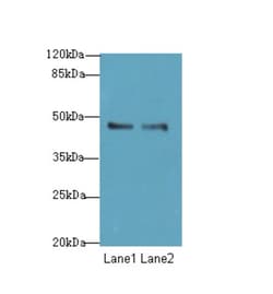 Epigentek Inc GPR34 Polyclonal Antibody (100 ul), Quantity: Each of 1