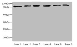 Epigentek Inc MCM3 Polyclonal Antibody (100 ul), Quantity: Each of 1