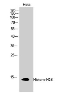 Epigentek Inc Histone H2B Polyclonal Antibody (100 ul), Quantity: Each