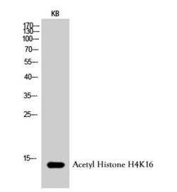 Epigentek Inc Histone H4K16ac (Acetyl H4K16) Polyclonal Antibody (50 ul),
