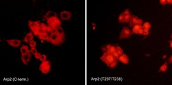 ECM Bioscience Arp2/3 Complex Regulation Antibody Sampler Kit, ECM Biosciences,