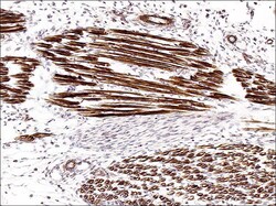 ECM Bioscience Actin Phospho-Regulation Antibody Sampler Kit, ECM Biosciences,