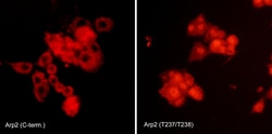 ECM Bioscience Arp2/3 Complex Antibody Sampler Kit, ECM Biosciences, Quantity: