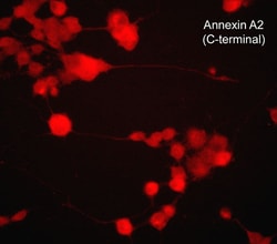 ECM Bioscience Annexin A2 (C-terminal region) Mouse Monoclonal Antibody,