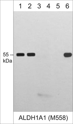 ECM Bioscience ALDH1A1 (N-terminal region) Mouse Monoclonal Antibody, ECM