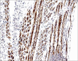 ECM Bioscience Atrogin-1 Rabbit Polyclonal Antibody, ECM Biosciences, Quantity: