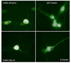 Cofilin Phospho-Regulation Antibody Sampler Kit, ECM Biosciences