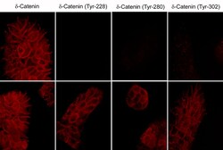 ECM Bioscience Crk II (C-terminal region) Mouse Monoclonal Antibody, ECM
