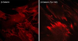 ECM Bioscience β-Catenin (N-terminal) Rabbit Polyclonal Antibody, ECM Biosciences,