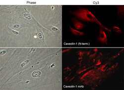 ECM Bioscience Coronin-1B (Ser-2), phospho-specific Rabbit Polyclonal Antibody,