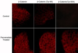 ECM Bioscience β-Catenin (Tyr-654)[γ-Catenin (Tyr-644)], phospho-specific