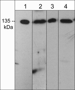 ECM Bioscience mDia2 (C-terminal region) Rabbit Polyclonal Antibody, ECM