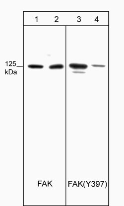 ECM Bioscience FAK (Tyr-397), phospho-specific Mouse Monoclonal Antibody,