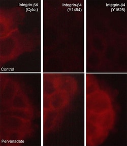 ECM Bioscience Integrin β4 Phospho-Regulation Antibody Sampler Kit, ECM