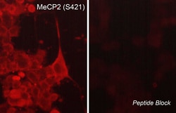 ECM Bioscience MeCP2 Phospho-Regulation Antibody Sampler Kit, ECM Biosciences,